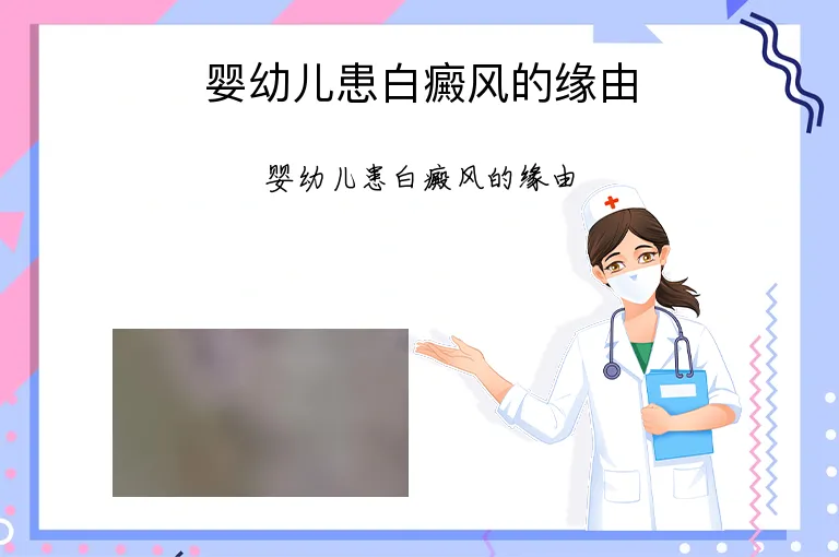 婴幼儿患白癜风的缘由