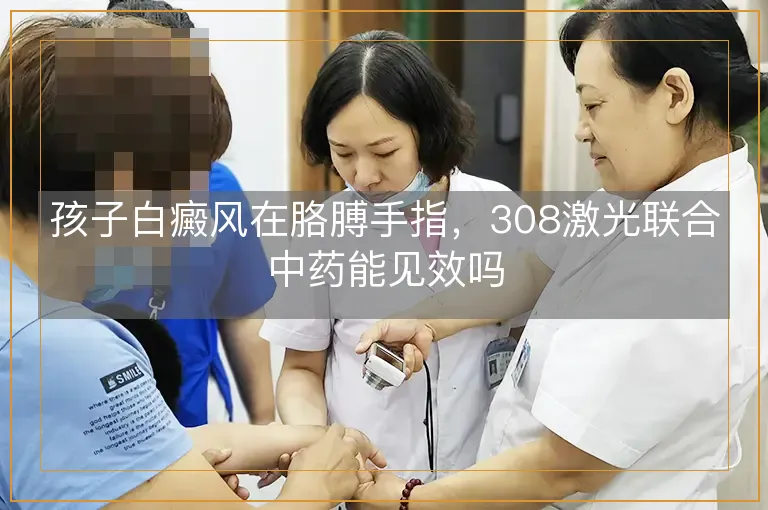 孩子白癜风在胳膊手指，308激光联合中药能见效吗
