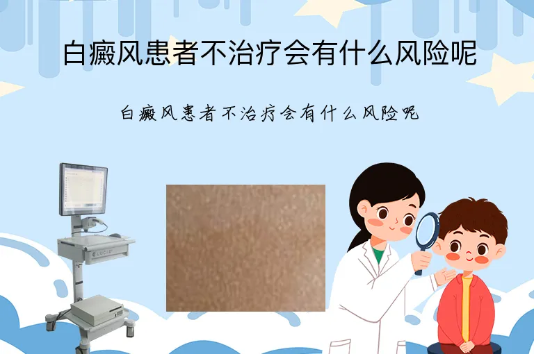 白癜风患者不治疗会有什么风险呢