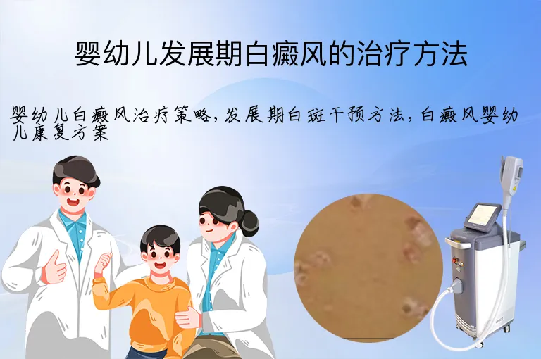 婴幼儿发展期白癜风的治疗方法