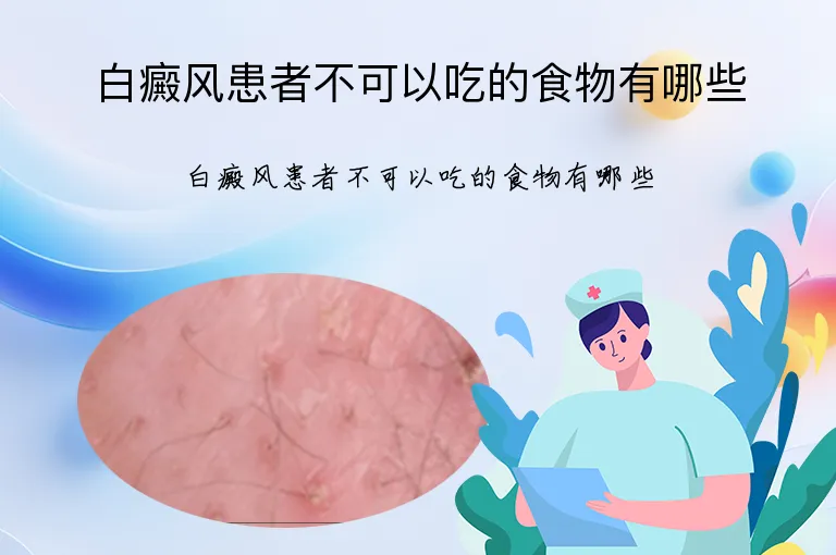 白癜风患者不可以吃的食物有哪些