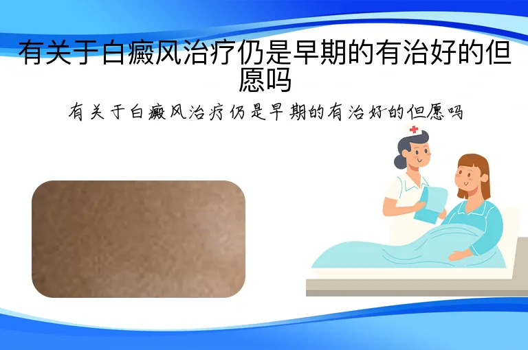 有关于白癜风治疗仍是早期的有治好的但愿吗