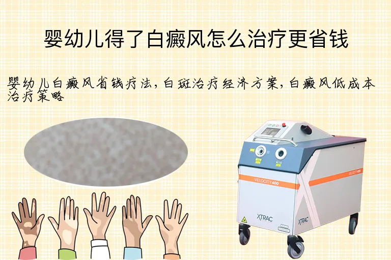 婴幼儿得了白癜风怎么治疗更省钱