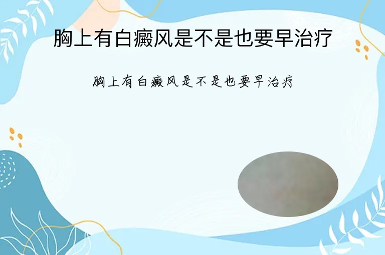 胸上有白癜风是不是也要早治疗