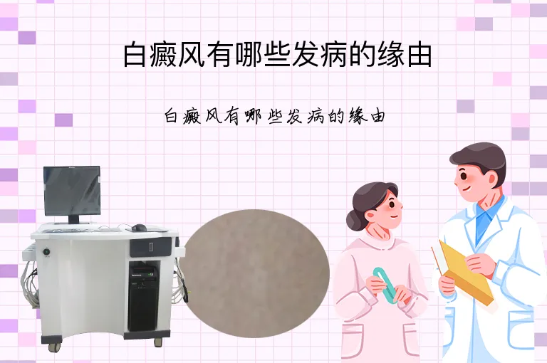 白癜风有哪些发病的缘由