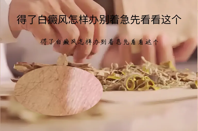 得了白癜风怎样办别着急先看看这个
