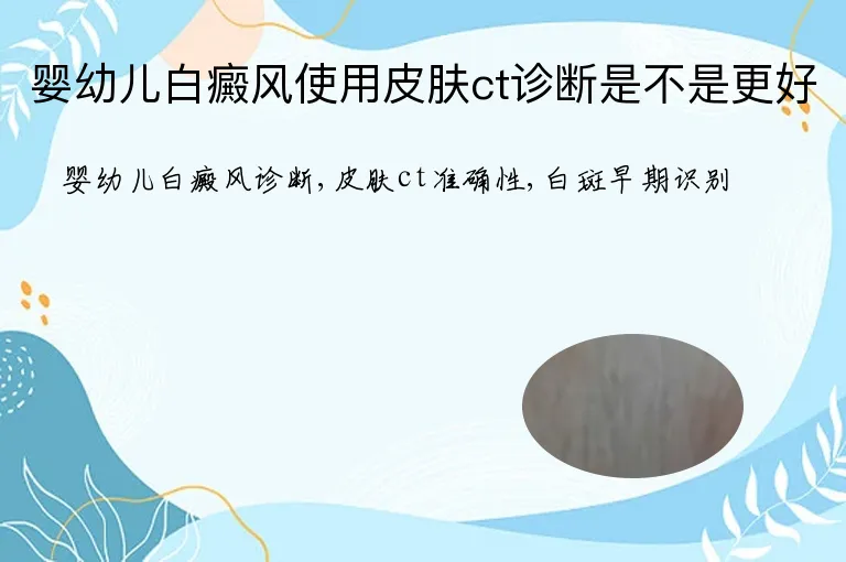 婴幼儿白癜风使用皮肤ct诊断是不是更好