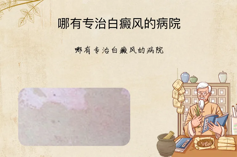 哪有专治白癜风的病院