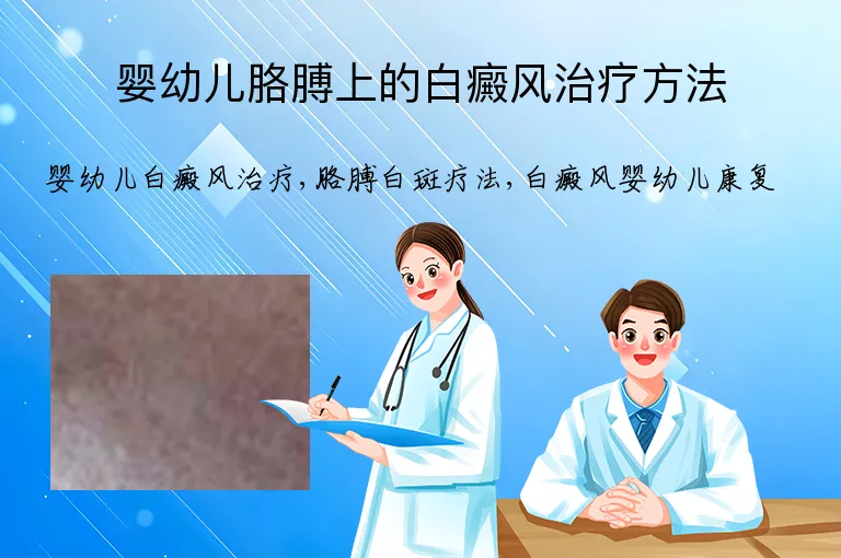 婴幼儿胳膊上的白癜风治疗方法