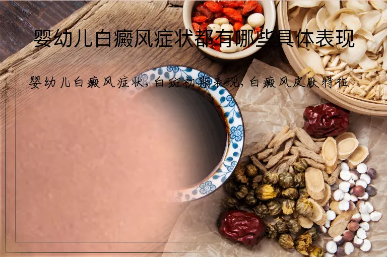 婴幼儿白癜风症状都有哪些具体表现