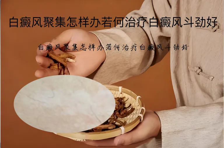 白癜风聚集怎样办若何治疗白癜风斗劲好