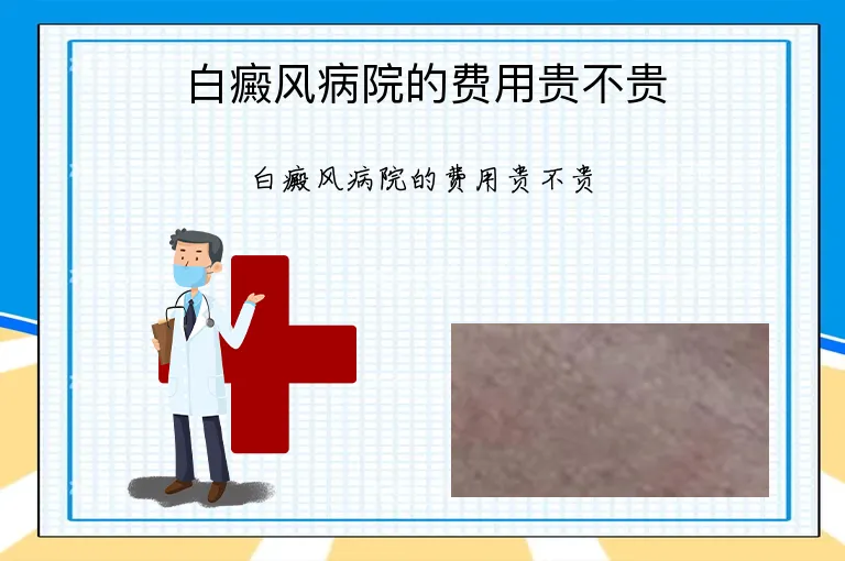 白癜风病院的费用贵不贵