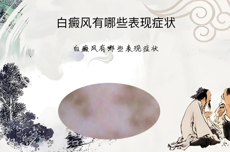 白癜风有哪些表现症状