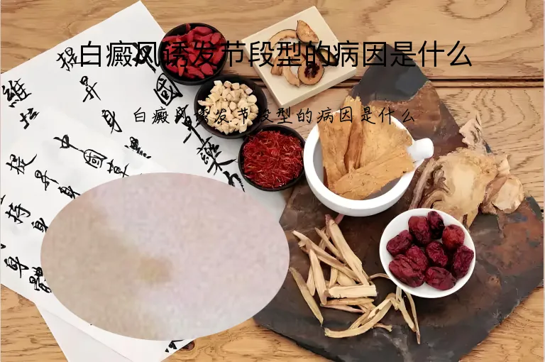 白癜风诱发节段型的病因是什么