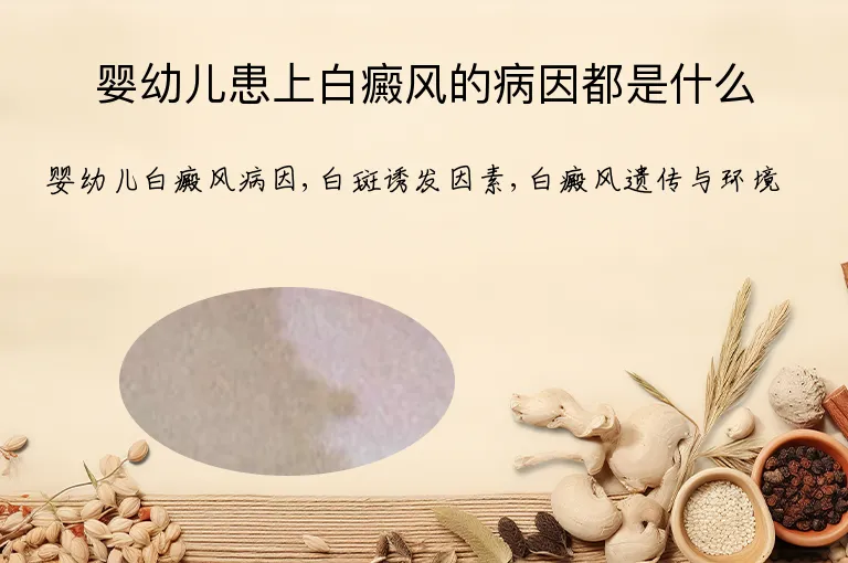 婴幼儿患上白癜风的病因都是什么