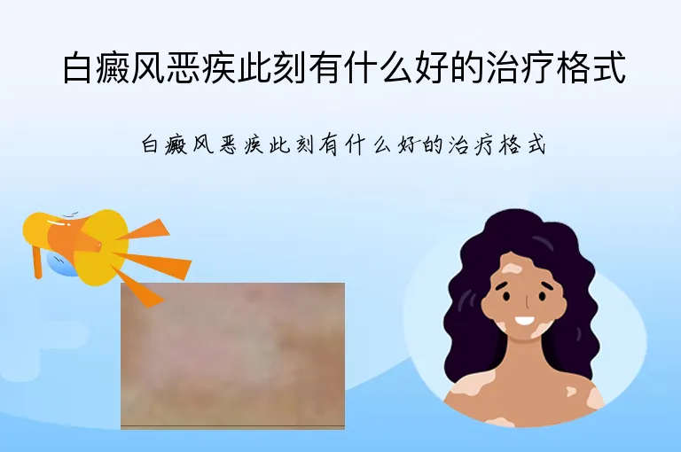 白癜风恶疾此刻有什么好的治疗格式