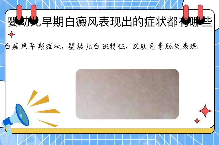 婴幼儿早期白癜风表现出的症状都有哪些