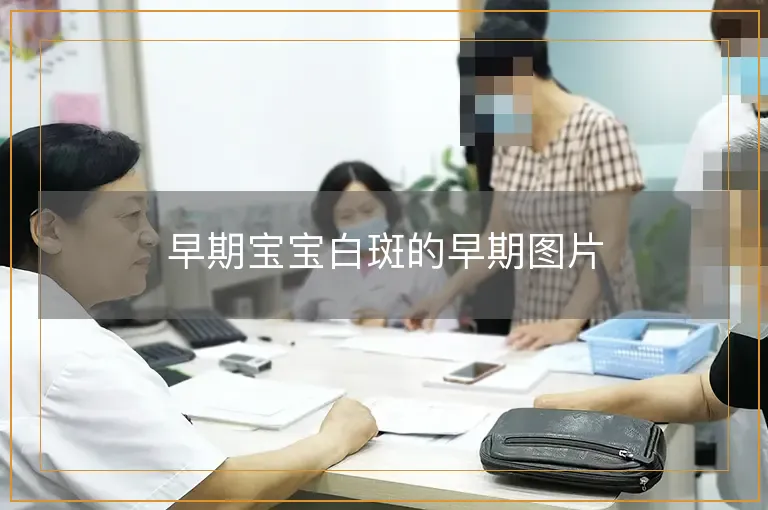 早期宝宝白斑的早期图片