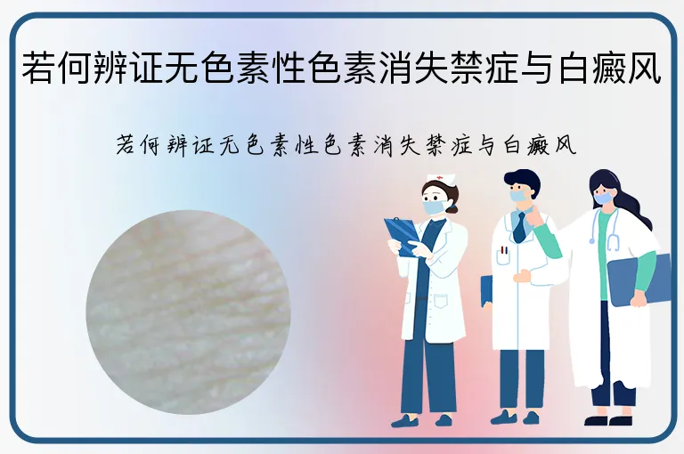 若何辨证无色素性色素消失禁症与白癜风