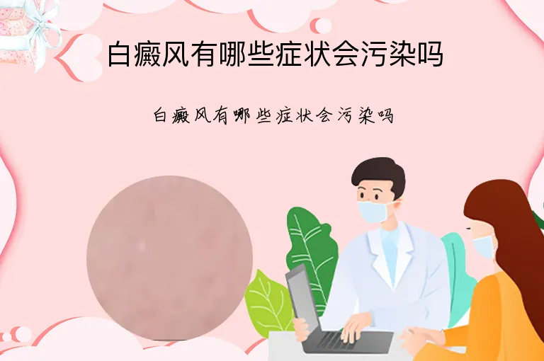 白癜风有哪些症状会污染吗