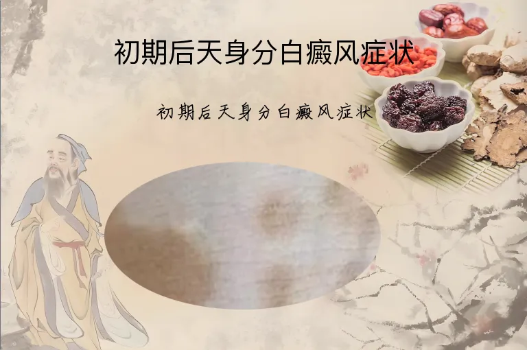 初期后天身分白癜风症状