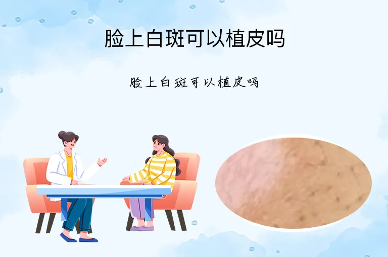 脸上白斑可以植皮吗