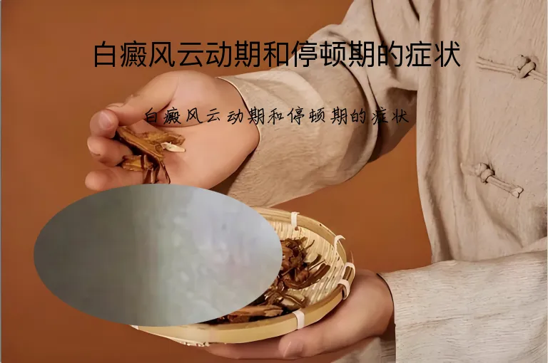 白癜风云动期和停顿期的症状