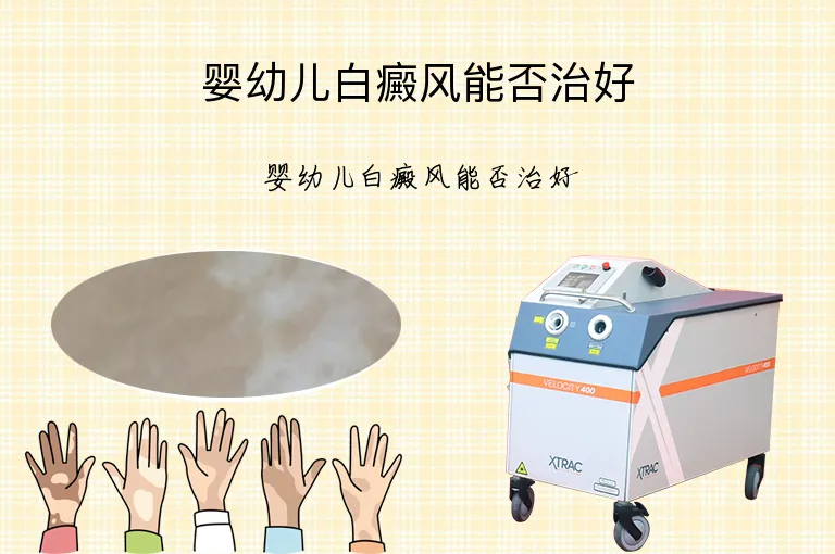 婴幼儿白癜风能否治好