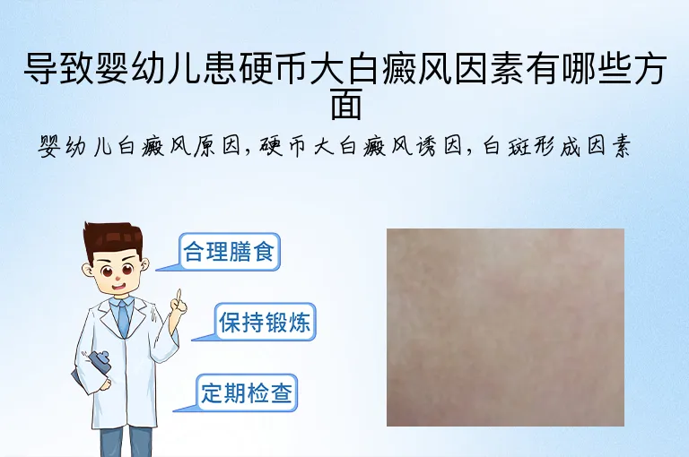 导致婴幼儿患硬币大白癜风因素有哪些方面