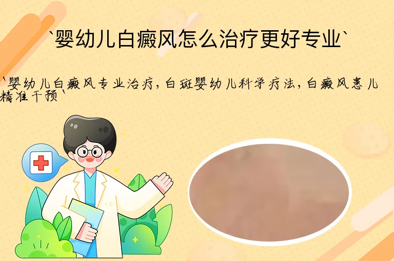 `婴幼儿白癜风怎么治疗更好专业`