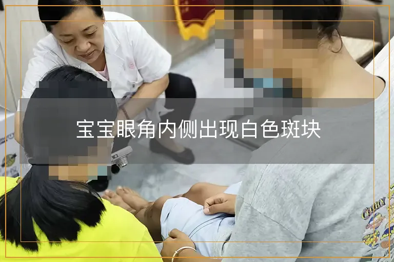 宝宝眼角内侧出现白色斑块
