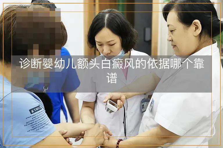 诊断婴幼儿额头白癜风的依据哪个靠谱