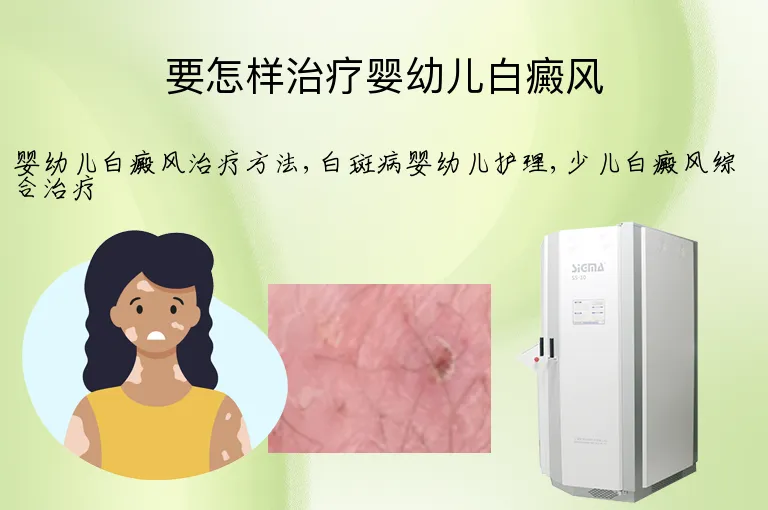要怎样治疗婴幼儿白癜风