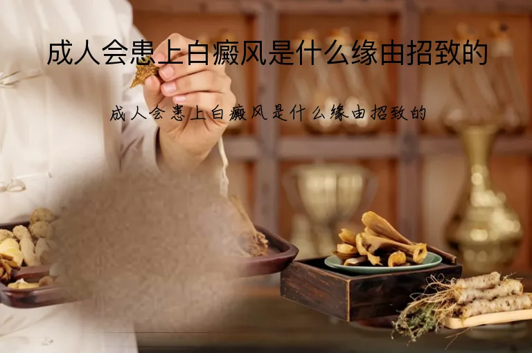成人会患上白癜风是什么缘由招致的