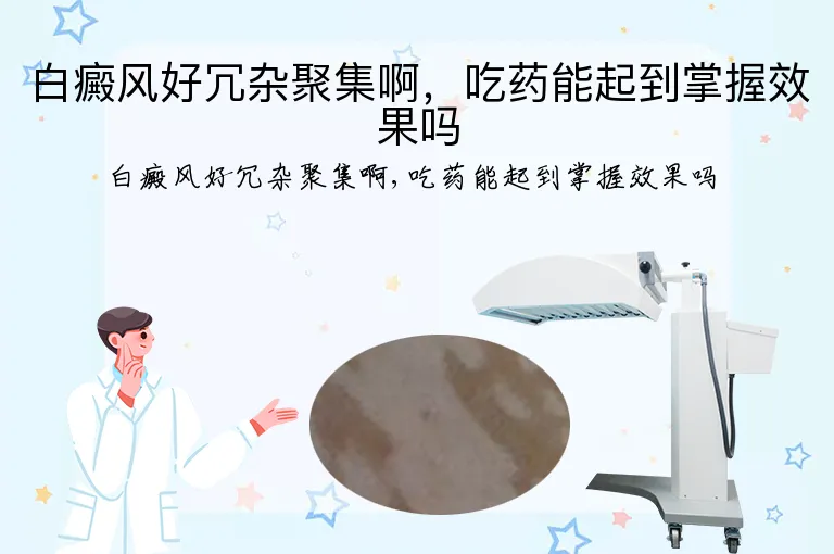 白癜风好冗杂聚集啊，吃药能起到掌握效果吗
