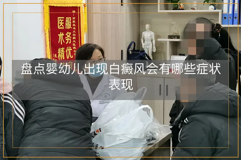 盘点婴幼儿出现白癜风会有哪些症状表现