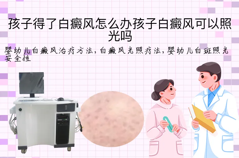 孩子得了白癜风怎么办孩子白癜风可以照光吗