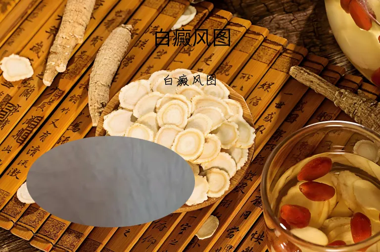 白癜风图