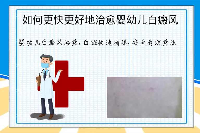 如何更快更好地治愈婴幼儿白癜风