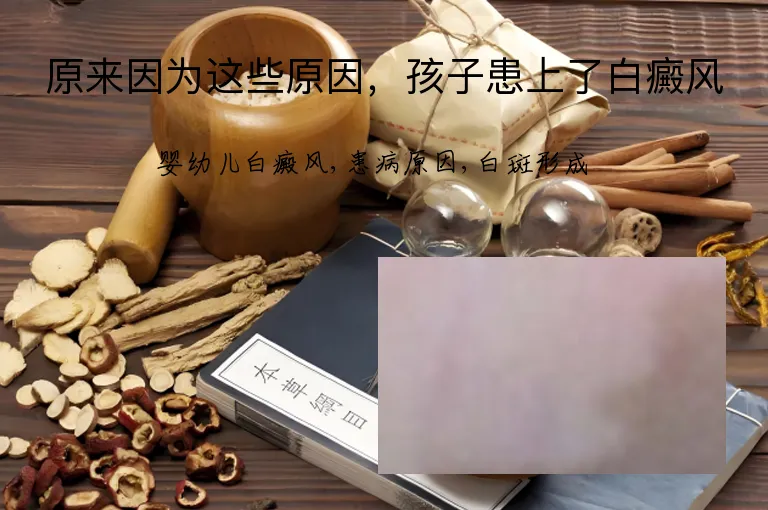 原来因为这些原因，孩子患上了白癜风