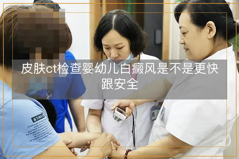 皮肤ct检查婴幼儿白癜风是不是更快跟安全