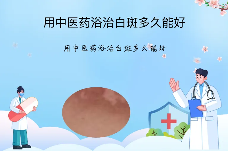 用中医药浴治白斑多久能好