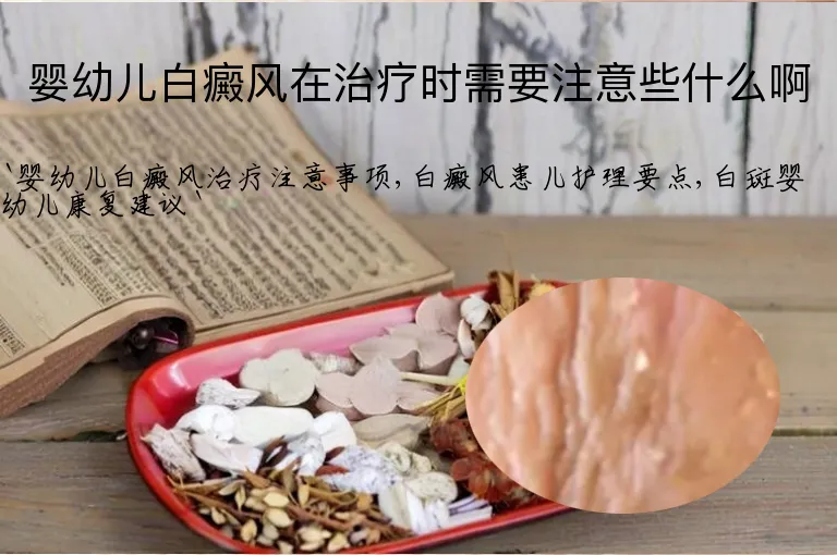 婴幼儿白癜风在治疗时需要注意些什么啊