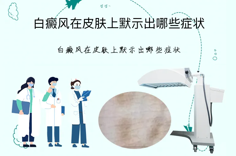 白癜风在皮肤上默示出哪些症状