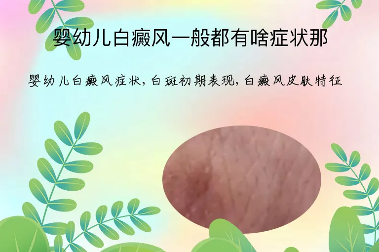 婴幼儿白癜风一般都有啥症状那