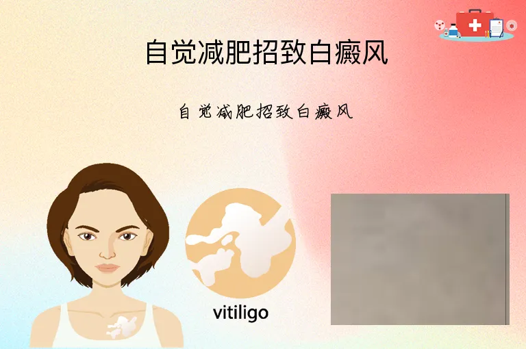 自觉减肥招致白癜风