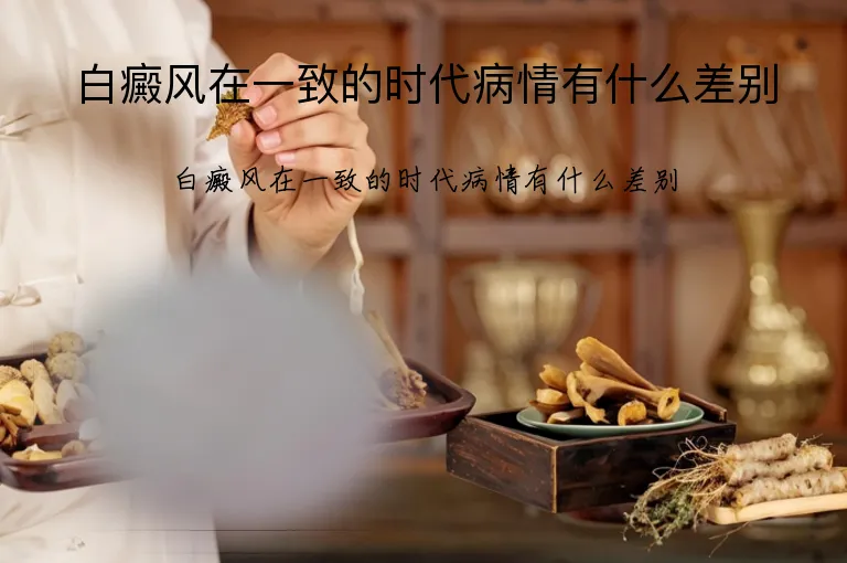 白癜风在一致的时代病情有什么差别