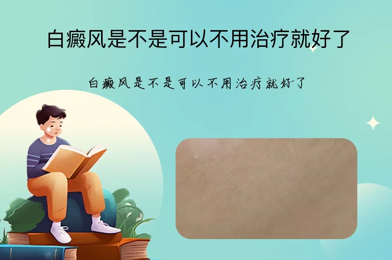 白癜风是不是可以不用治疗就好了