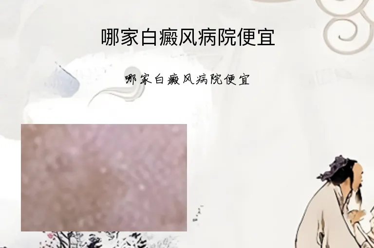 哪家白癜风病院便宜
