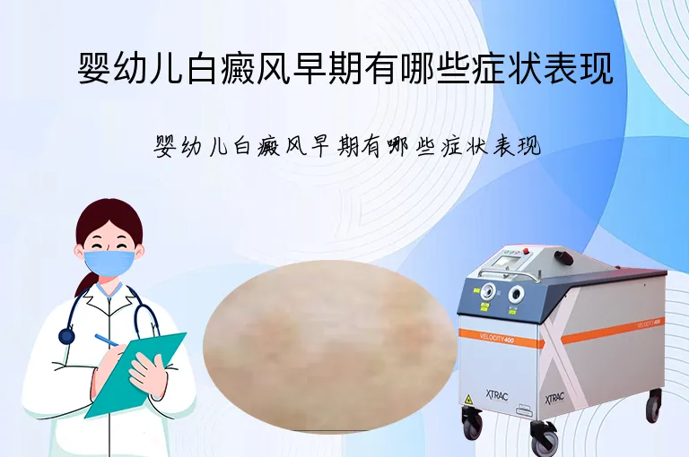 婴幼儿白癜风早期有哪些症状表现